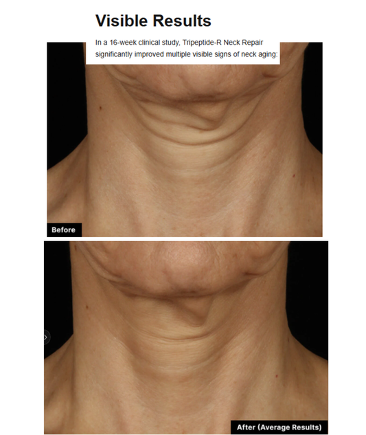 SkinCeuticals Tripeptide-R Neck Repair